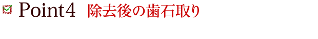 Point4 除去後の歯石取り